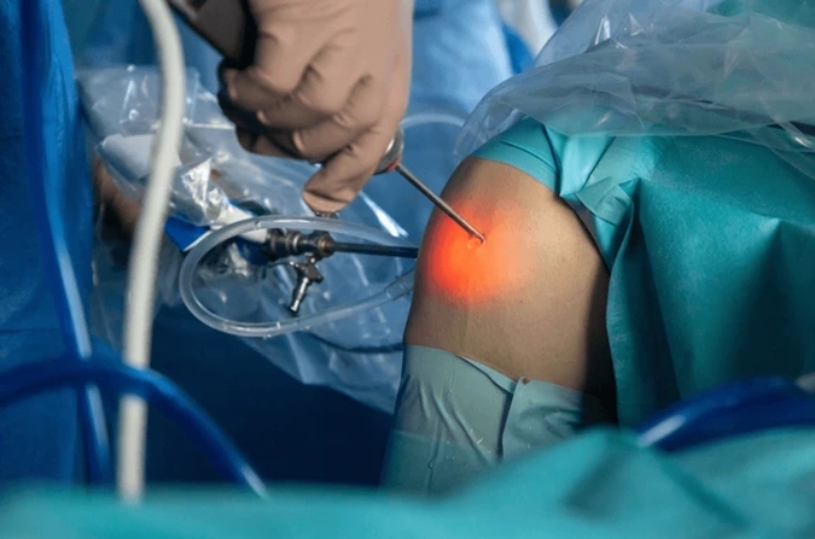 Arthroscopy-15-1.jpg